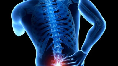 Bel Ağrısı ve Bel Fıtığı